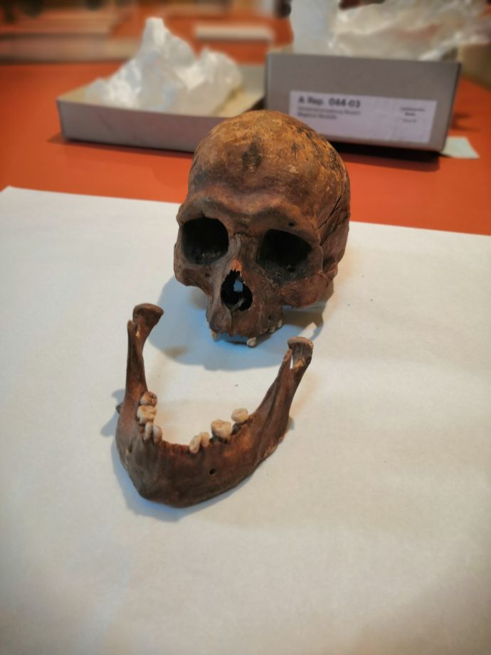 Foto eines menschlichen Schädels auf einem Tisch. Der Unterkiefer ist vom Schädel getrennt und liegt vor dem schädel.